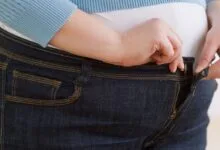 الكرش عند النساء